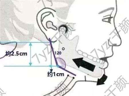 顴骨整形手術(shù)的安全因素怎么樣?