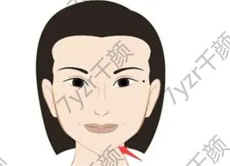 下巴整形的方法有哪些，注意事項有哪些