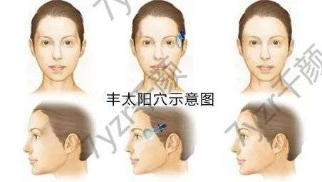 豐太陽穴臉會變大嗎?怎么快速消腫？