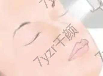 白娃娃祛斑有什么果，會(huì)反彈嗎