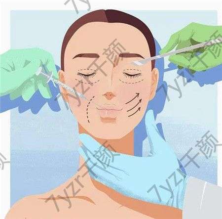 雙眼皮手術(shù)適合哪些人群?有哪些注意事項