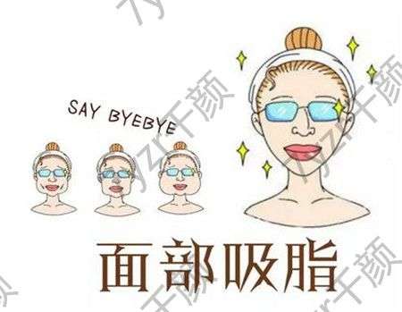 面部吸脂術(shù)的優(yōu)勢是什么，步驟是怎么樣的
