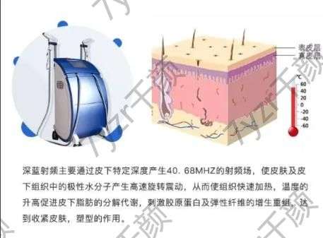 射頻緊膚有什么副作用，需要多少錢(qián)