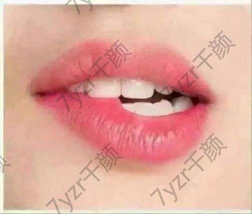 紋唇有哪些副作用呢？