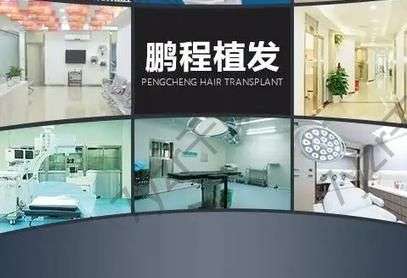 深圳調(diào)節(jié)脫發(fā)的正規(guī)醫(yī)院匯總單前六強(qiáng)收好了!個(gè)個(gè)手術(shù)技藝！