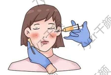 注射玻尿酸的價格及副作用