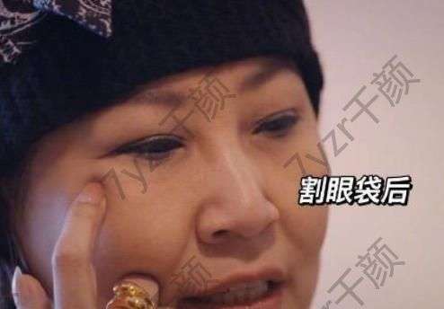 迪斯科女王之稱的張薔喊話整形醫(yī)生:下一單割眼袋要認(rèn)真負(fù)責(zé)