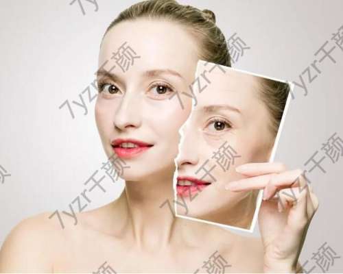 不整容更年輕?脂肪移植比沒有整容效果的4D整容好