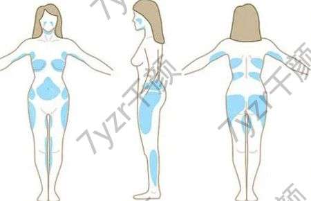 吸脂手術(shù)會(huì)留疤嗎?術(shù)后要注意什么