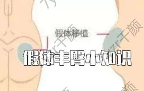 為什么要用定制的低凸假體做豐臀?