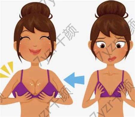 假體隆胸的效果可以維持一生嗎?