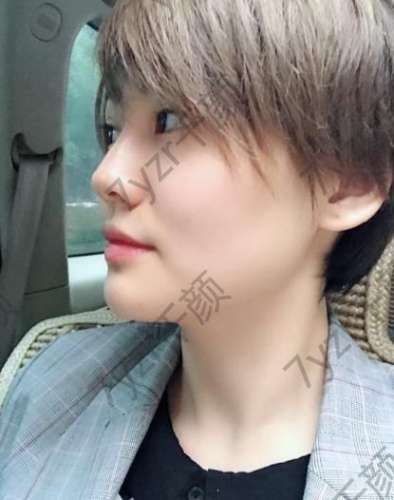 做水光針已經(jīng)半個月啦，皮膚現(xiàn)在是越來越好了