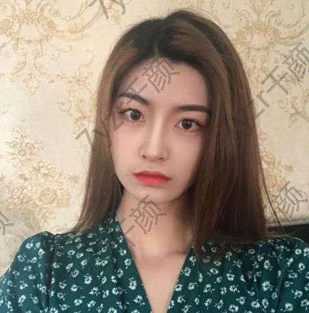 一說到假體隆鼻手術(shù)