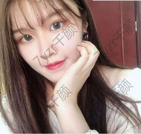 打完水光針之后就很明顯的感覺到皮膚變好了很多