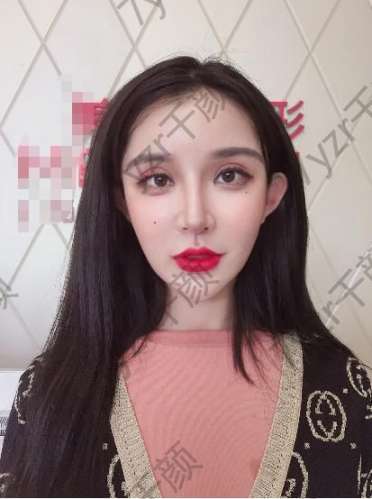 對于水光針這個項目我也是慢慢嘗試的