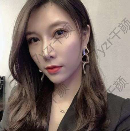 做隆鼻手術(shù)的醫(yī)院是我比較熟悉的醫(yī)院