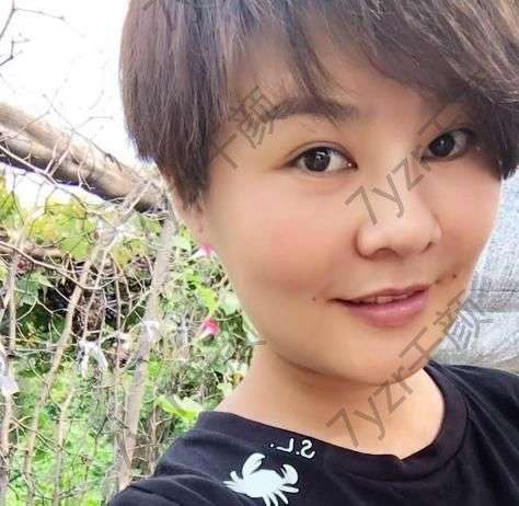 自從打完了瘦臉針咬肌真的變小了很多