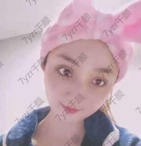 雙眼皮手術(shù)后的第一天手術(shù)開始前我總是很緊張