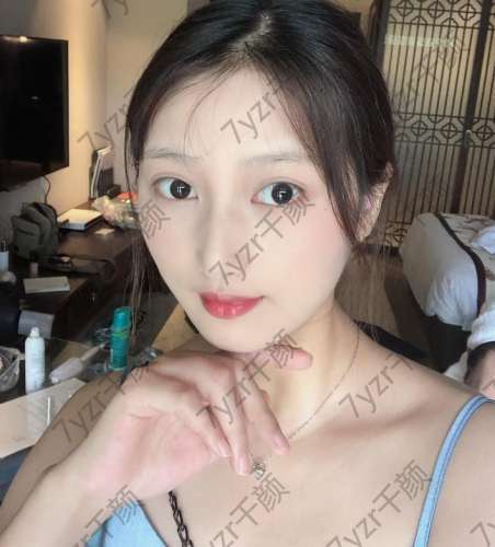 今天是我線雕的第三天只是稍微紅腫了一下