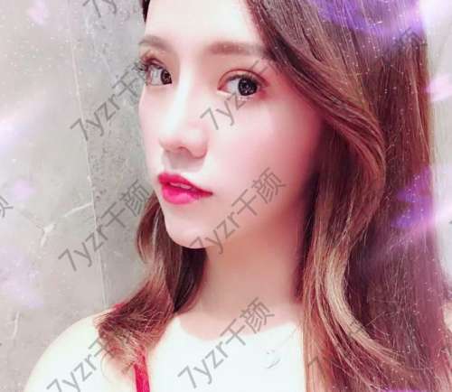 手術(shù)前眼睛不對稱眼皮的一側(cè)不好看