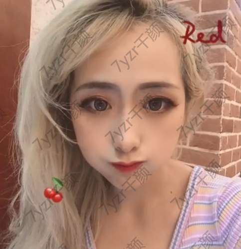 線雕用的線會刺激皮膚下膠原組織的產(chǎn)生，對皮膚有很大的改良