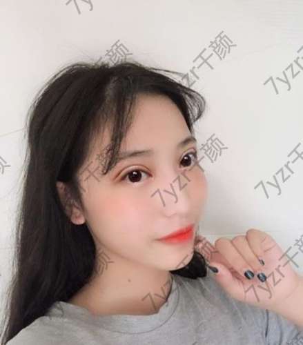 我今年做了一件有勇氣的事，就是從單眼皮變成雙眼皮