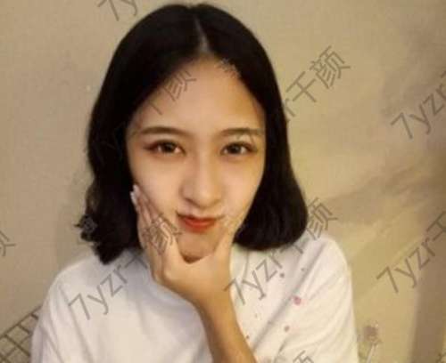 切開(kāi)雙眼皮是未來(lái)長(zhǎng)期效果好的