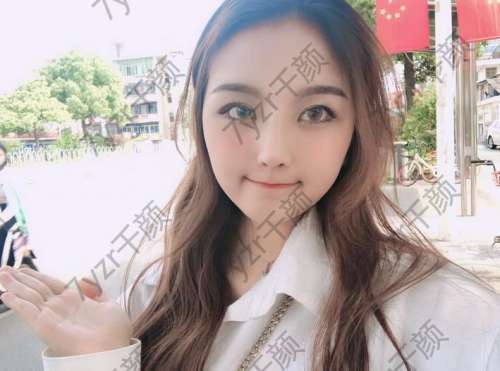 這次隆鼻只是為了讓自己變美