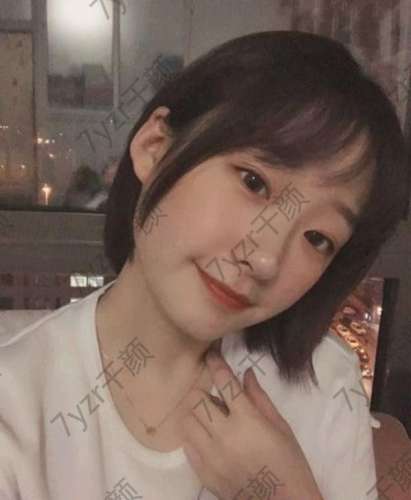 埋線雙眼皮手術(shù)后一個(gè)月