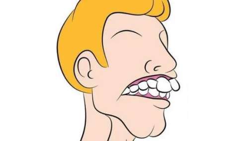 齙牙矯正的一般費(fèi)用是多少？終于揭秘！