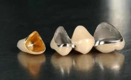 高效安全的牙齒美容方案：磨小裝烤瓷牙，讓您擁有自信燦爛的笑容！