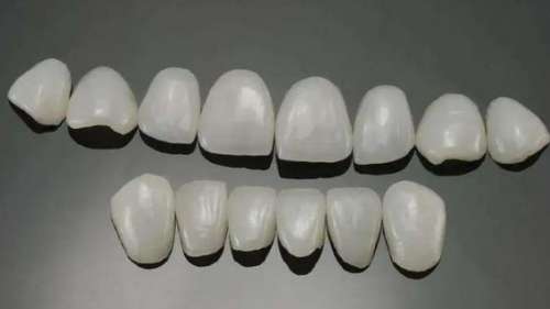 瓷貼面：打造高品質(zhì)裝飾效果的必備材料