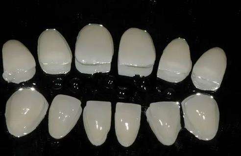 全瓷貼面?zhèn)溲缊D解，輕松掌握備牙技巧！