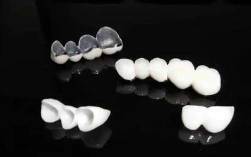 超值優(yōu)惠！純鈦烤瓷牙多少錢？讓您輕松擁有自信美牙！