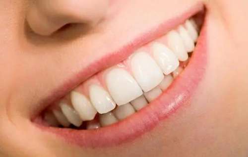 瓷貼面牙齒價格一覽，20顆牙齒多少錢？