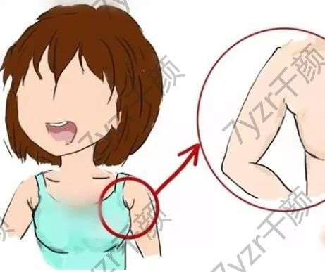 副乳切除術(shù)會影響身體嗎，副乳切除復(fù)雜嗎