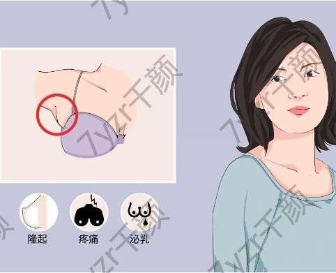 副乳切除后的注意事項有哪些，需要怎么護理