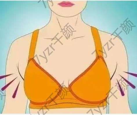 副乳切除有哪些風(fēng)險，有哪些并發(fā)癥