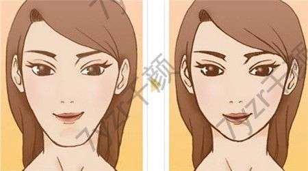 假體墊下巴有哪些材料可供選擇