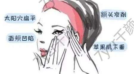 自體脂肪填充蘋果肌有哪些優(yōu)點?