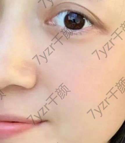 敏感肌的救星！舒淇的護(hù)膚秘訣大揭秘，讓你擁有如雞蛋般嫩滑肌膚